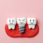 Keep Your Dental Implants Healthy