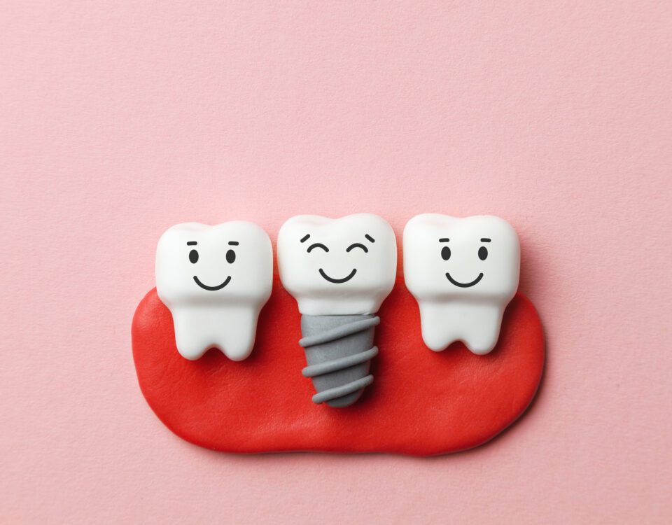 Keep Your Dental Implants Healthy